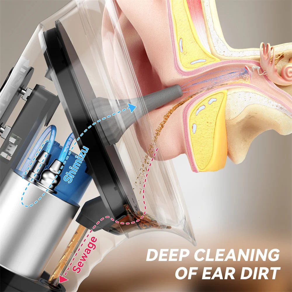 Electric Water Ear Cleaning System – Hygienic & Painless