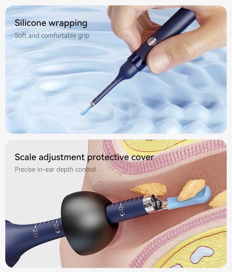 Nettoyeur d’oreilles avec caméra HD – Vision précise et nettoyage sécurisé