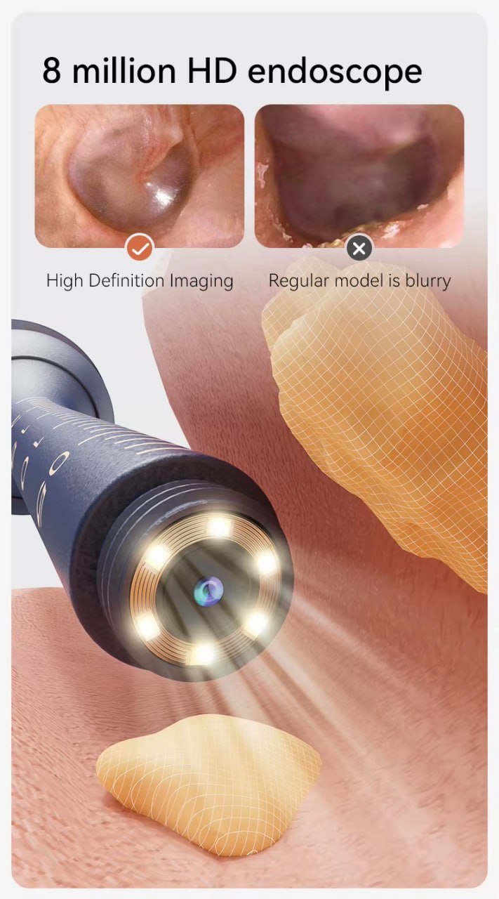 Nettoyeur d’oreilles avec caméra HD – Vision précise et nettoyage sécurisé