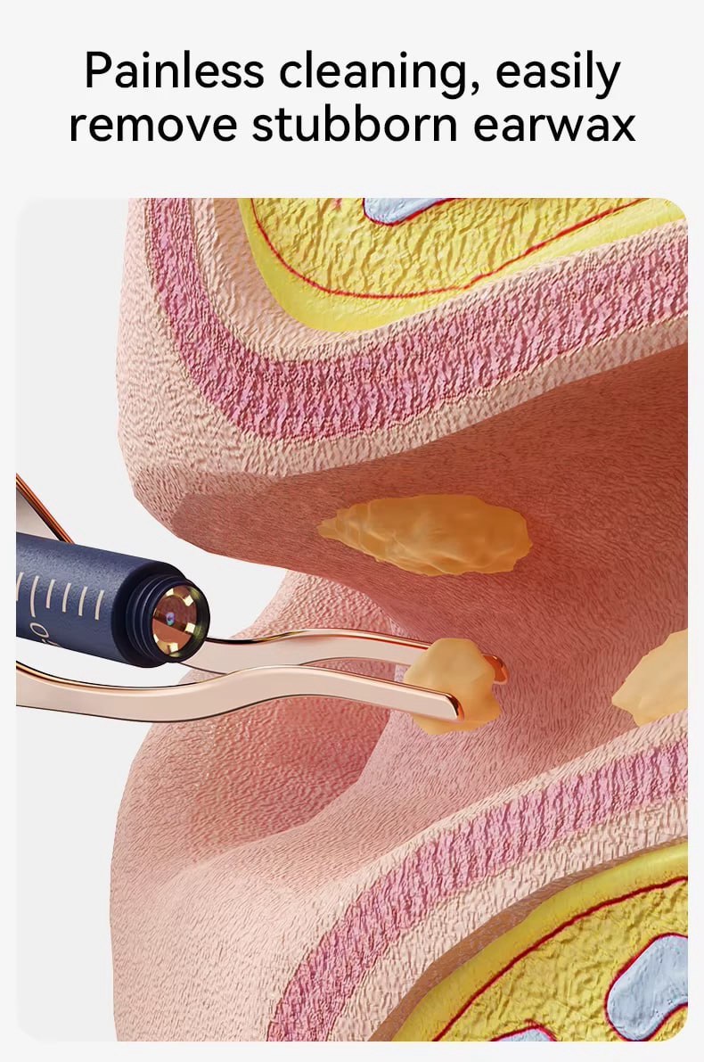 Nettoyeur d’oreilles avec caméra HD – Vision précise et nettoyage sécurisé